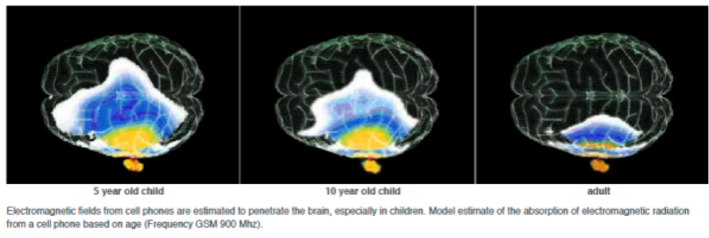 Pénétration des champs EM dans le cerveau selon l'âge